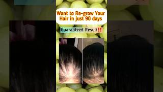 Amla Juice For Hair Growthcontrols Hair Fallamla Benefits For Hair