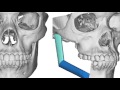 Department of Oral and Maxillofacial Surgery University of Maryland School of Dentistry