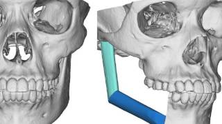 Department of Oral and Maxillofacial Surgery University of Maryland School of Dentistry