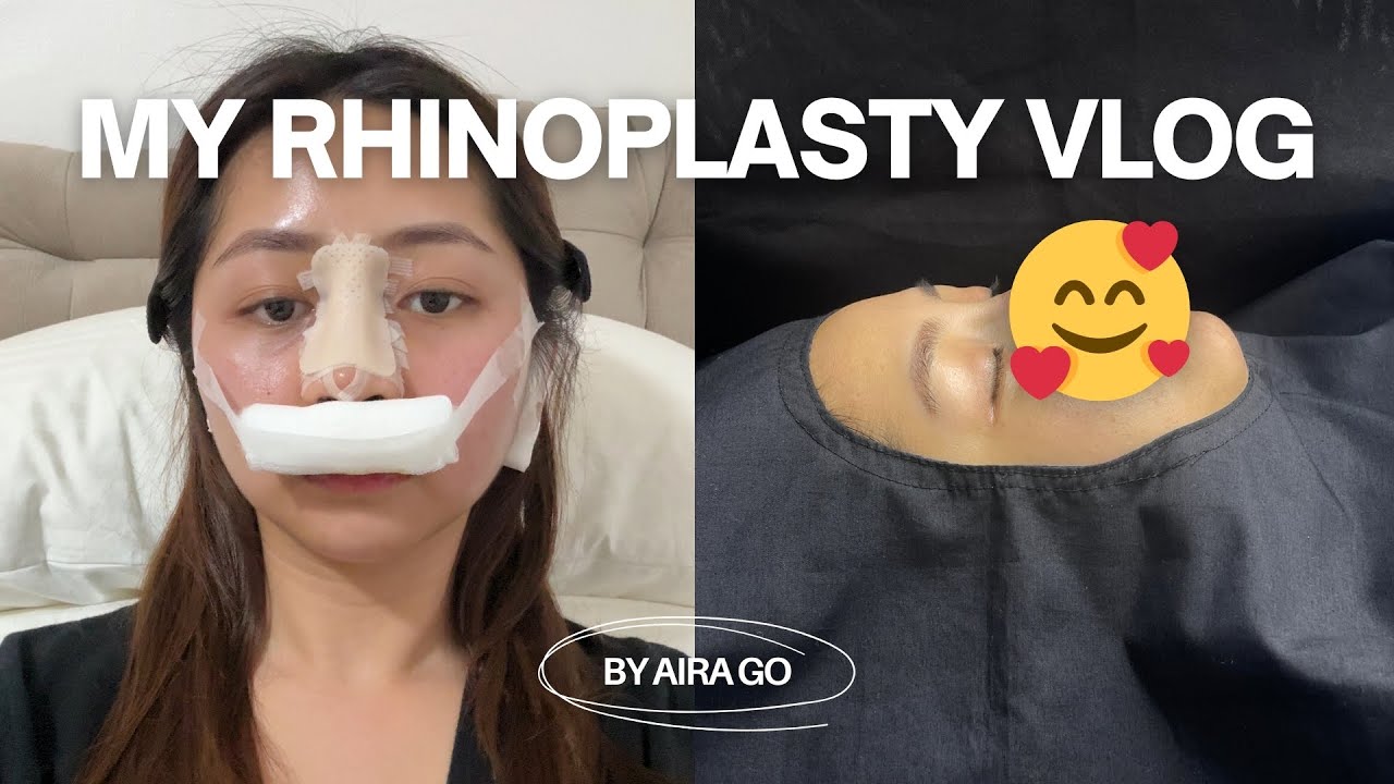 MY RHINOPLASTY JOURNEY | Aira Go
