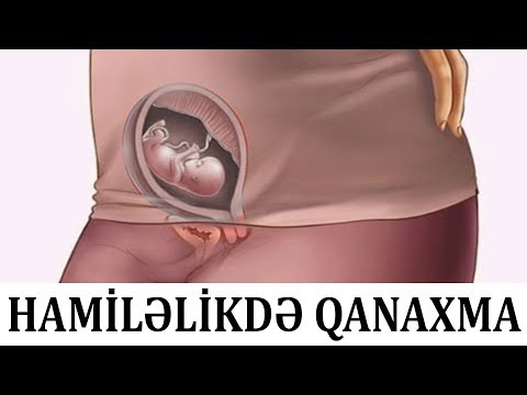 Hamiləlikdə qanaxma nədən xəbər verir?