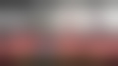 Uniportal VATS Right S2b+S3a Segmentectomy　単孔式胸腔鏡下右肺S2b+S3a区域切除術