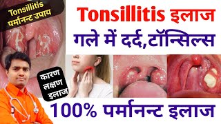 Tonsils की समस्या इन 3 दवाइयों से हमेशा के लिए ख़त्म करें | Tonsil Stone | Tonsillitis Treatment screenshot 2