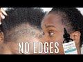 HOW TO: GROW BACK YOUR EDGES FAST + WASH DAY ROUTINE |IAMTRUDYTALEE