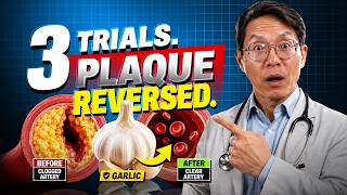 I Ate the Wrong Garlic for Years (The One That Actually Reverses Plaque) screenshot 4