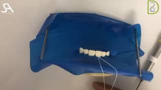 Dentiscope | Anterior Rubber Dam Isolation  With no clamp