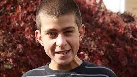 FRAGILE X SYNDROME COMMON SYMPTOMS