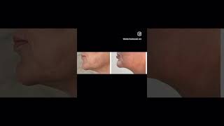 Разоблачаем мифы о массаже лица😉 #массаж  #massage #красотаназдоровье#facial #skincare #relax