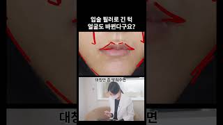 입술만 손봤는데 턱 비율이 달라졌어요