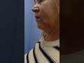 Замена лифтов кмз и млм 1980 и млм 2000 на лифты нлм 24 или 25 года