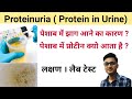 proteinuria in hindi | proteinuria symptoms | proteinuria treatment | proteinuria symptoms in hindi