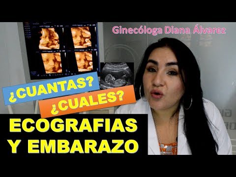 ECOGRAFIAS RECOMENDADAS durante el EMBARAZO POR GINECOLOGA DIANA ALVAREZ ¡Descubre a los Cuantos Meses es Recomendable Hacer un Ultrasonido!