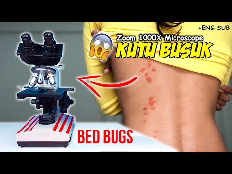 PENAMPAKAN KUTU BUSUK DI MIKROSKOP | Bed Bugs Under Microscope Zoom 1000X