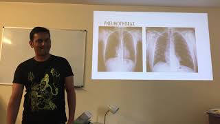 FRCEM INTERMEDIATE SAQ HIGH YIELD 5 #FRCEM #EmergencyMedicine #EM #MRCEM