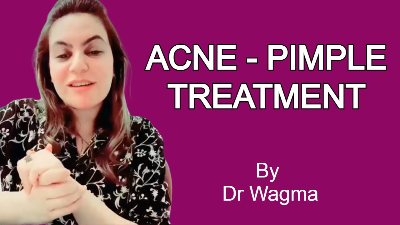 Acne Treatment (what causes Acne) YouTube