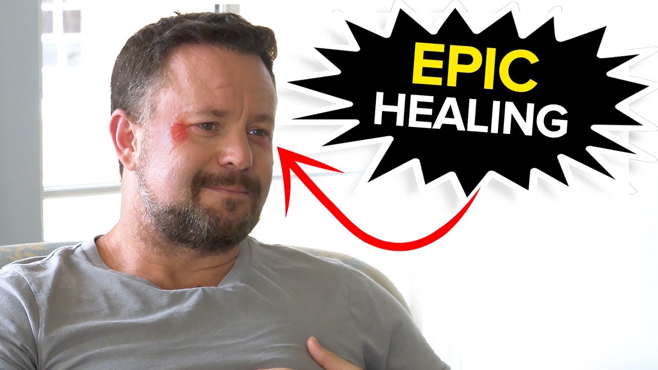 UNBELIEVABLE HEALING CAUGHT ON CAMERA | Kerwin Rae and Peter Crone