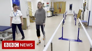 'I lost my arm and leg in an accident on the Tube'