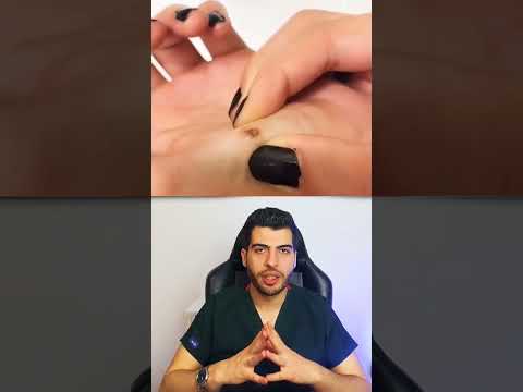 التهاب الجلد جلدية تجميل ليزر جلدية قيح احمرار التهاب التهاب الجلد د مصعب حسوا ثقف نفسك طبيا