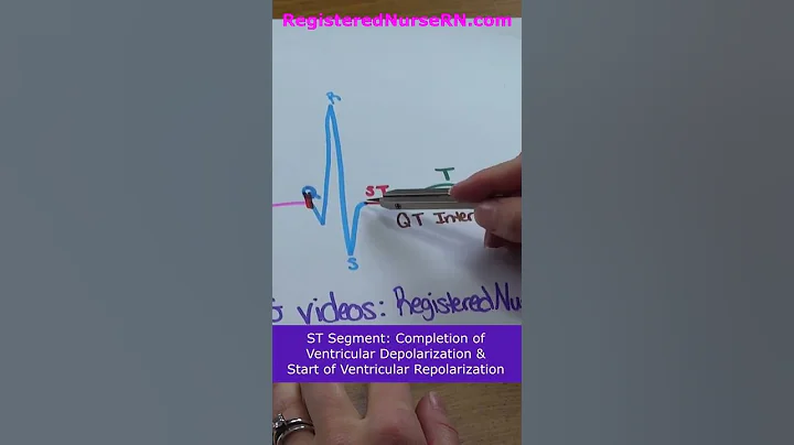 ECG / EKG Waveform Parts Explained in Less Than 1 Minute (PQRST Complex) #shorts