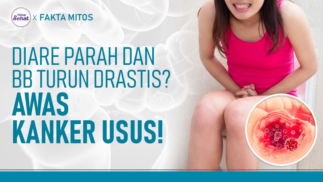 Gejala Kanker Usus, Salah Satunya Diare Terus Menerus dan Berat Badan Turun | Hidup Sehat tvOne