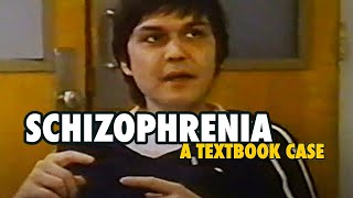 "Textbook Case" of Schizophrenia