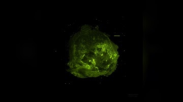 A virtual reality journey through a tumour