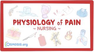 Physiology Of Pain Clinical Nursing Care