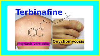 terbinafine