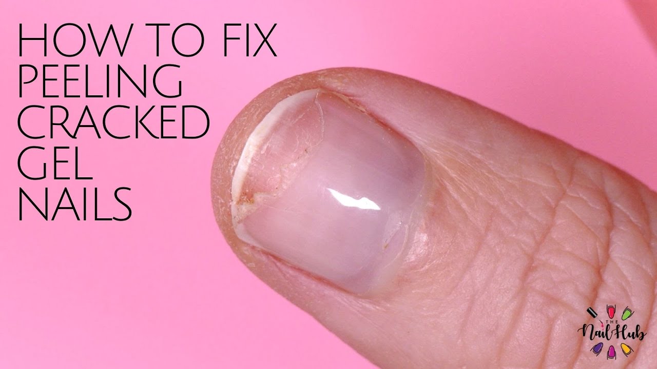 Ridges in Fingernails: Causes and Treatments - Riverchase Dermatology