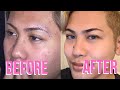 How I CLEARED my skin | Updated skincare routine
