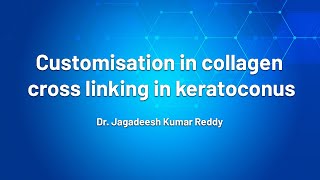 Customisation in Collagen cross linking in keratoconus - Dr. J. K. Reddy