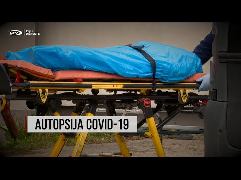 "Aculiecinieks" : Covid-19 autopsija