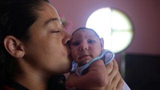 U.S. CDC concludes Zika causes microcephaly, other birth defects
