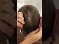 Total MAN WIG/ Parrucche uomo NEWLACECU