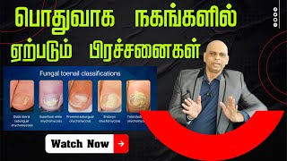 பதவக நகஙகளல ஏறபடம பரசசனகள Nail Problem Explain By Dr Jeyakumar Jk Plastic Surgeon