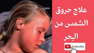 خطوات علاج حروق الشمس من البحر فى الصيف☀️treatment and recovery لو رايح المصيف screenshot 4