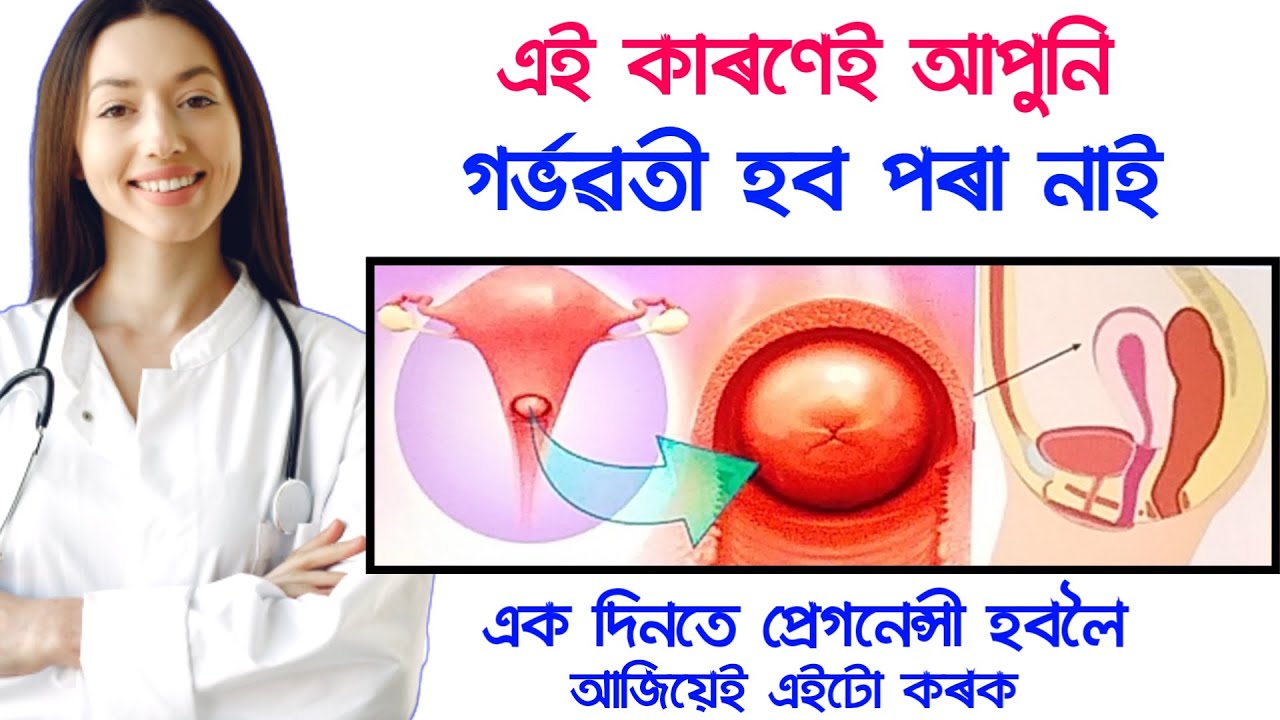 গৰ্ভাশয়ৰ মুখ খোলা আছে যদি 1 দিনতে প্ৰেগনেন্সী হৈ যাব