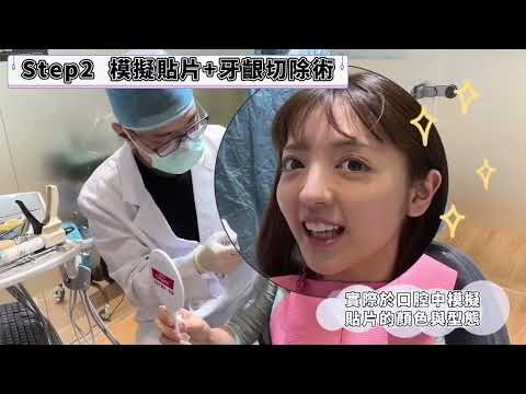 【尊榮貼片美齒計劃】網紅變漂亮的秘密—女神級陶瓷貼片，唇紅齒白一百分💯