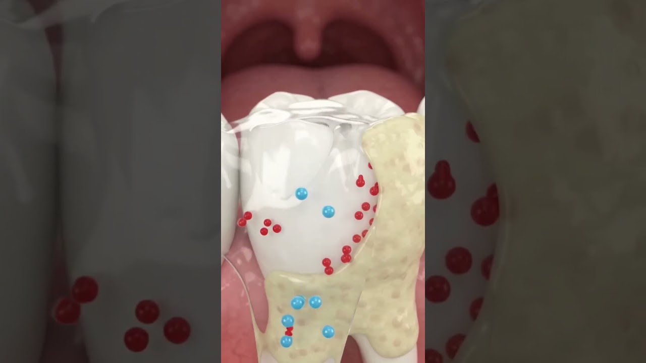 How Do Teeth Decay? 🦷 Dental Caries Explained in 3D Animation | Class 10 Science #Shorts
