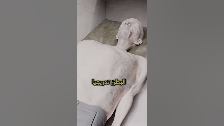 تغيرات في الجسم بعد وفاة الشخص