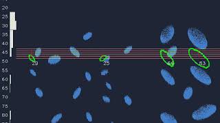 Metavision® Intelligence Ultra High Speed Particle Size Estimate Net Worth