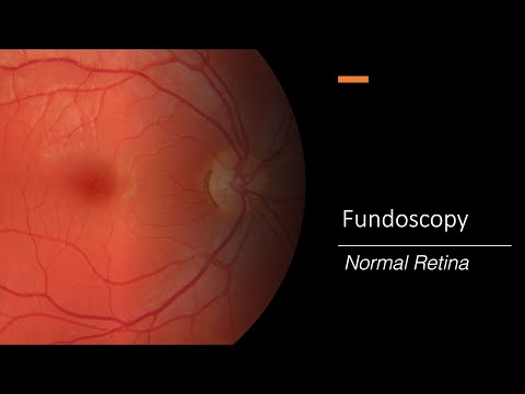 Video: Care este fovea centralis?