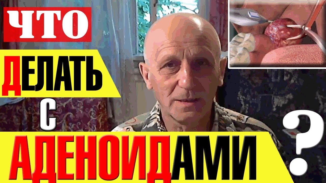 АДЕНОИДЫ: КАК СПАСТИ РЕБЕНКА ОТ СКАЛЬПЕЛЯ?!