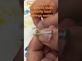How I removed my daughter’s stuck butterfly back earrings easily!