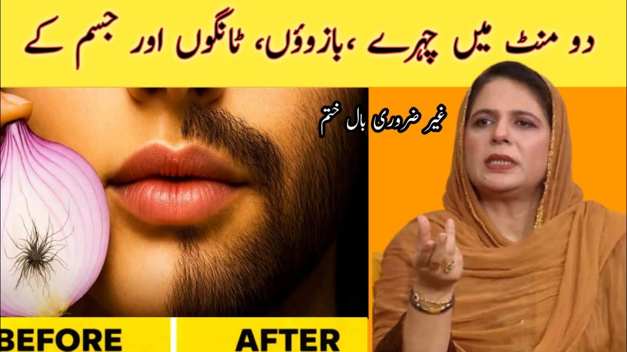 Permanent hair removal at home | Best Hair Removal Cream | Painless hair removal | DIY Remedies