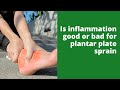 Is inflammation good or bad for plantar plate sprain
