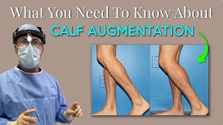 Famous No More Skinny Legs!! Calf Augmentation with Dr. Chasan Profile