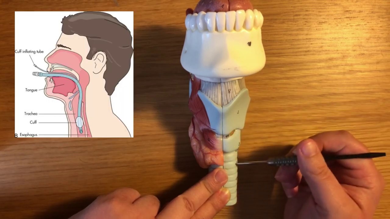 Laryngeal Anatomy Part 1 external features of larynx & applications to