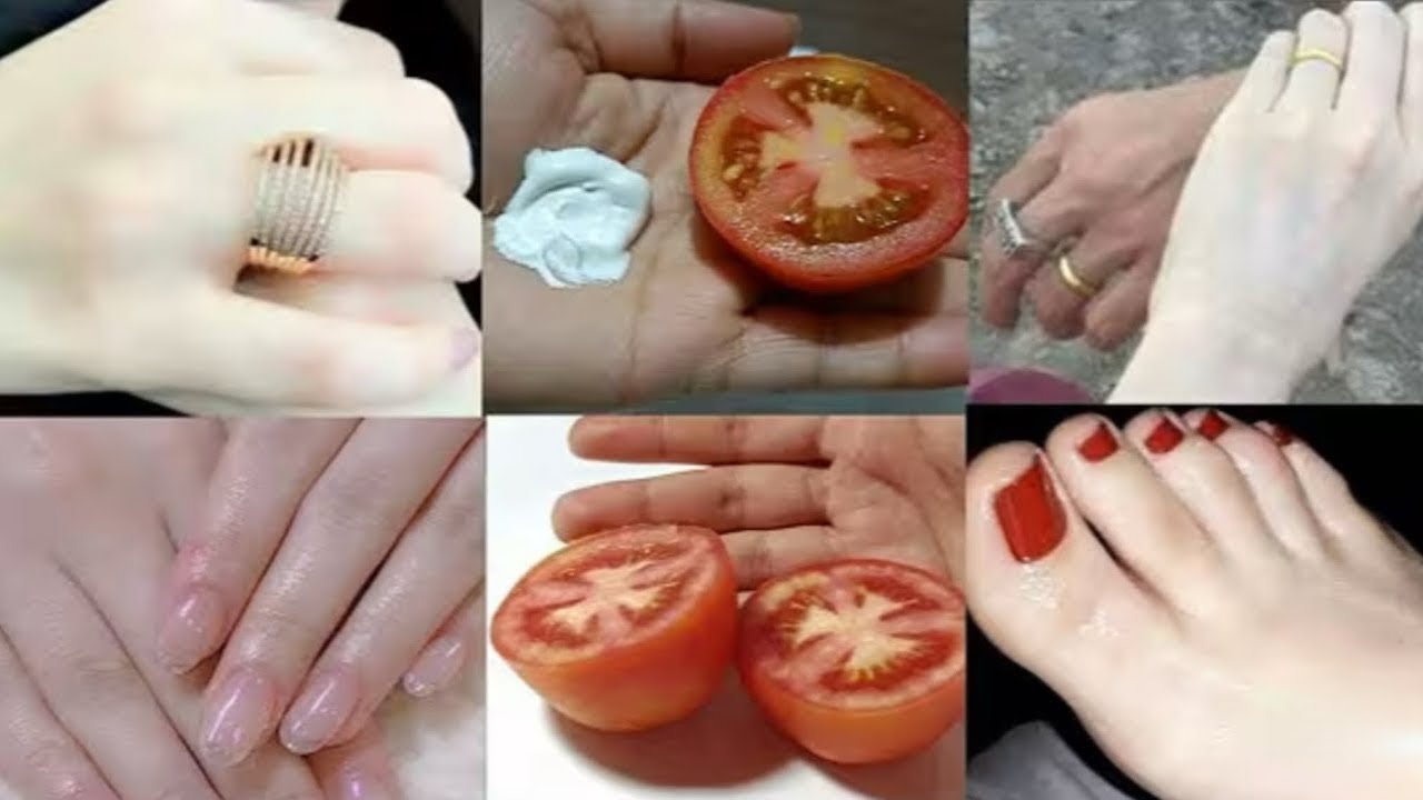 1 ही बार के इस्तेमाल से चेहरा इतना गोरा खूबसूरत कर देगा की लोग देखते रह जायेंगे Spotless Bright Skin