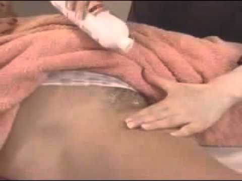 Brazilian Wax Video Nude 89